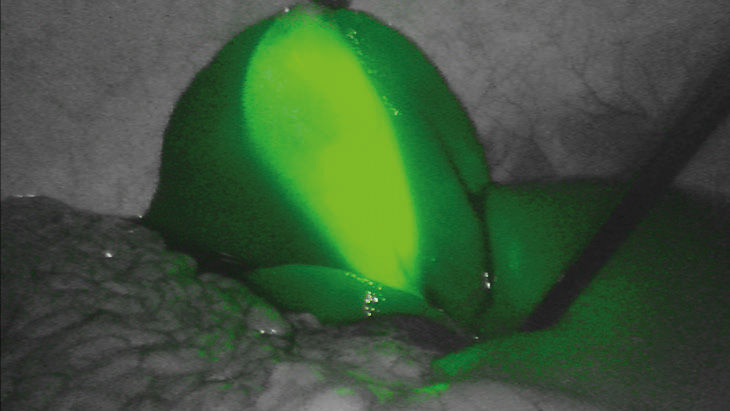 FI verde - Tecnologia di imaging a fluorescenza 3D
