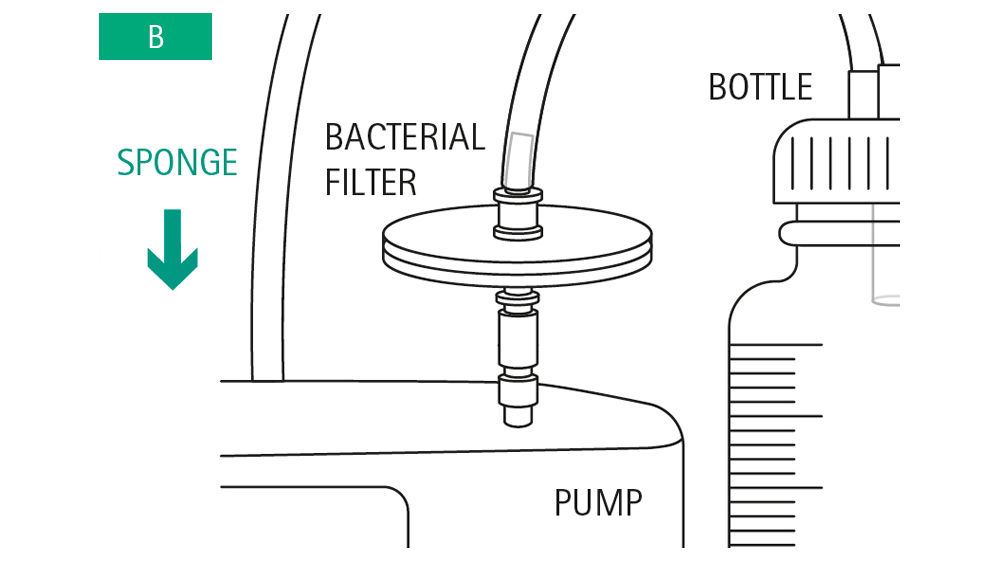 Illustrazioni: Collegare il filtro alla pompa utilizzando un Luer Lock. Collegare quindi il tubo flessibile del cilindro dal flacone dei secreti al filtro.