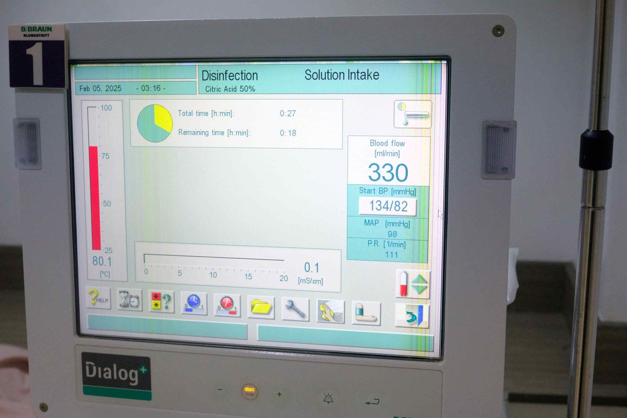 The hemodialysis System "Dialog+" with digital display