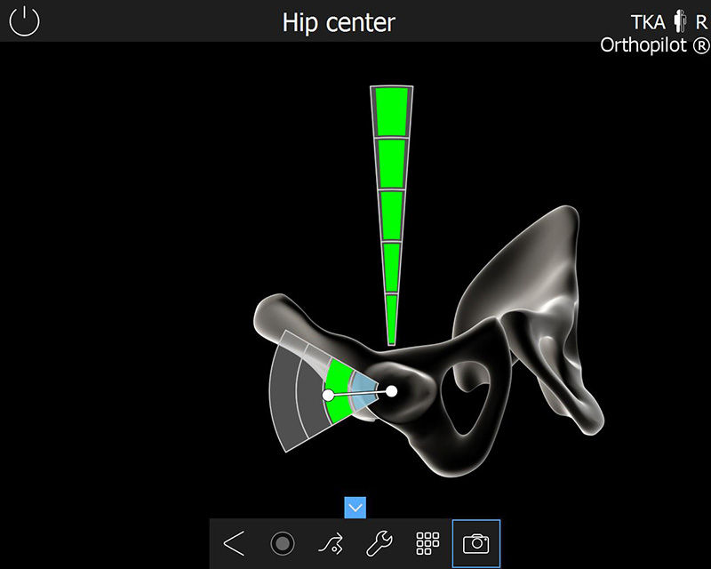 Screenshot del software OrthoPilot® TKA - Centro dell'anca