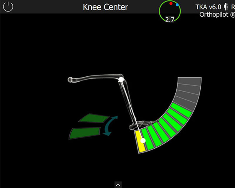 Screenshot del software OrthoPilot® TKA - Knee center
