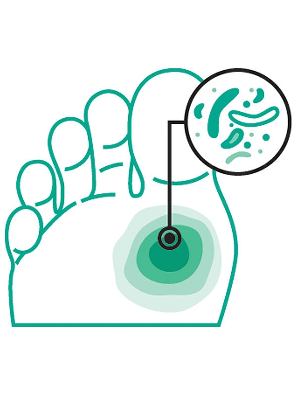 Foot icon with a highlighted ulcer and bacteria icons, representing signs of infection.
