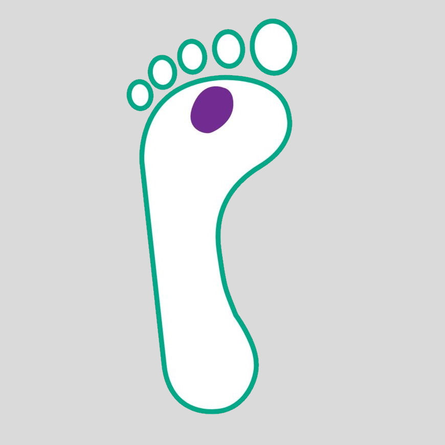 illustrazione dell'ulcera del piede diabetico di grado 2