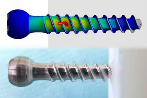 Ottimizzazione in silico di un nuovo design di viti peduncolari e convalida mediante risultati sperimentali